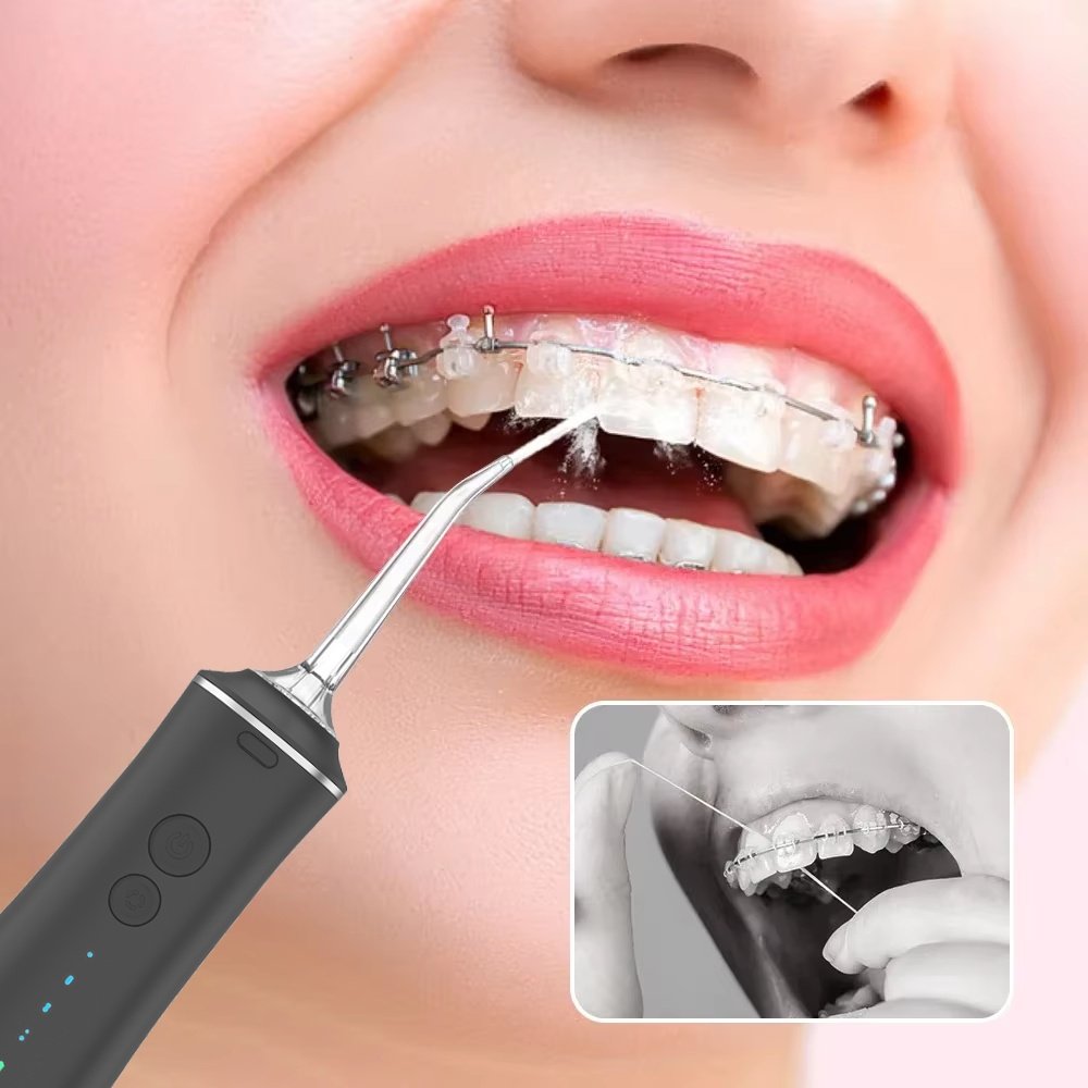 Rechargeable Water Flosser – Deep Clean for Braces & Teeth